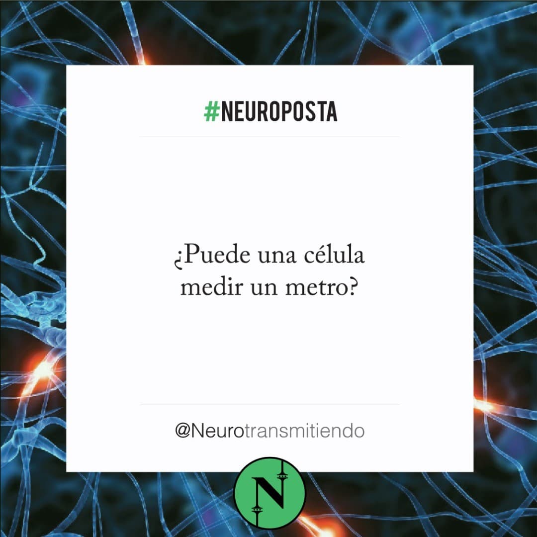 #Neuroposta 
