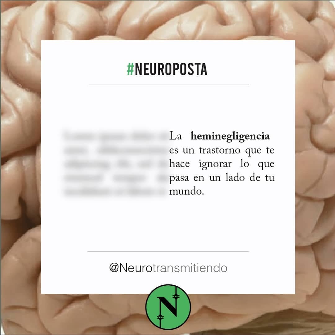 #Neuroposta