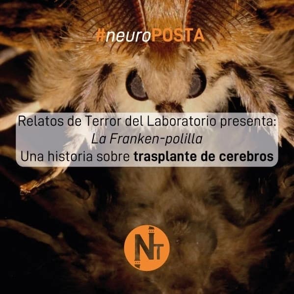 #Neuroposta