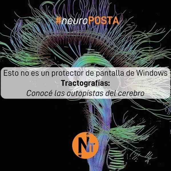 #Neuroposta
