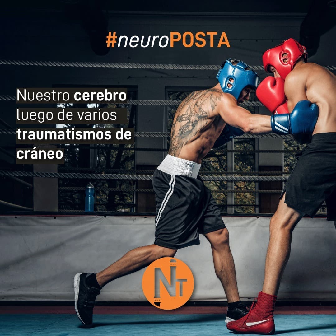 #Neuroposta