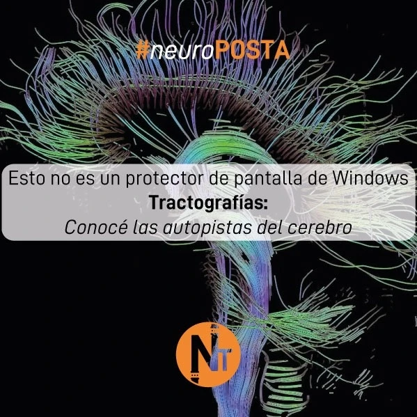 #Neuroposta