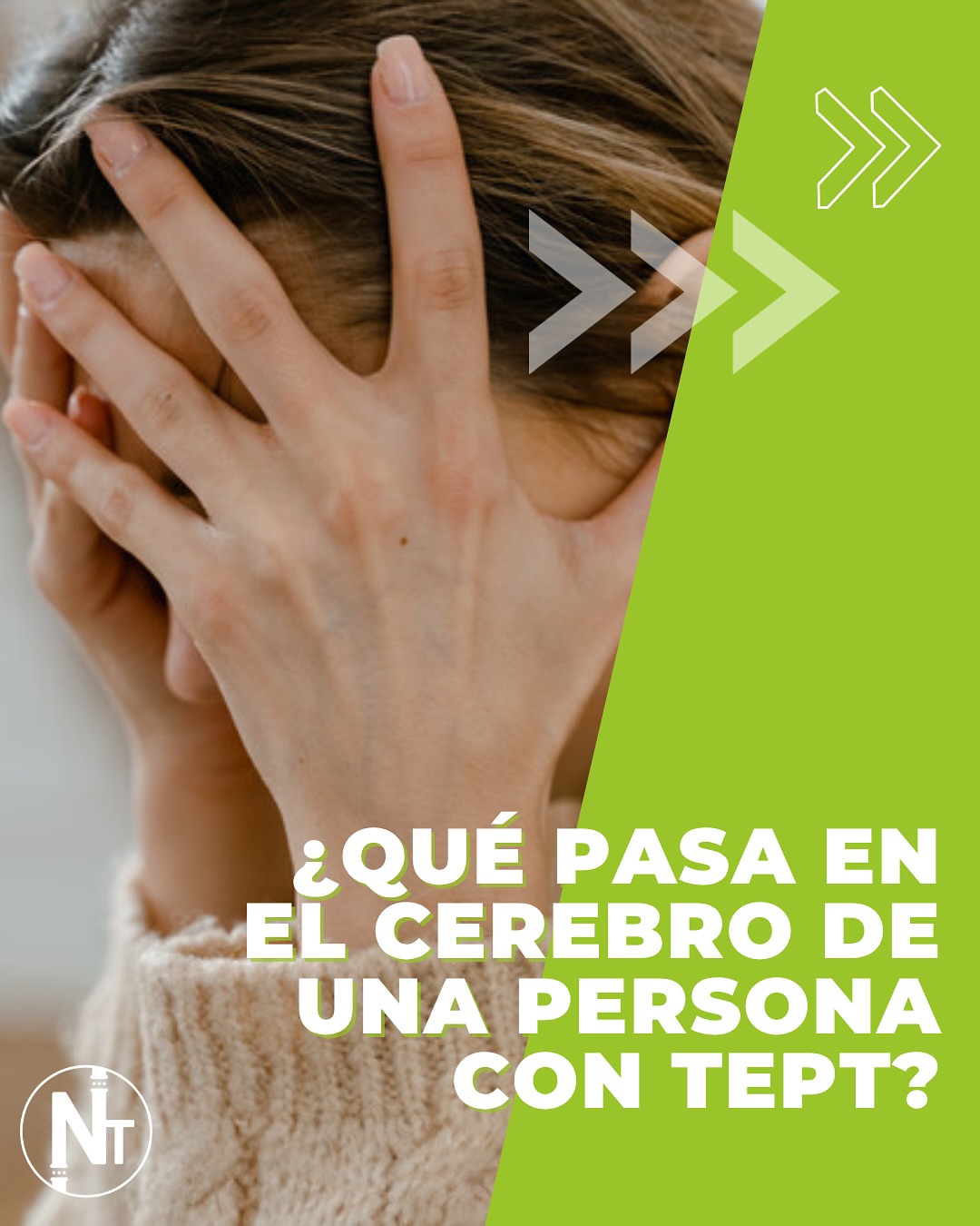 El Estrés Postraumático (TEPT) en Argentina: Afecta al 2.8% de nuestra población tras vivir un evento traumático. 🇦🇷